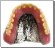総入れ歯コバルトクロム